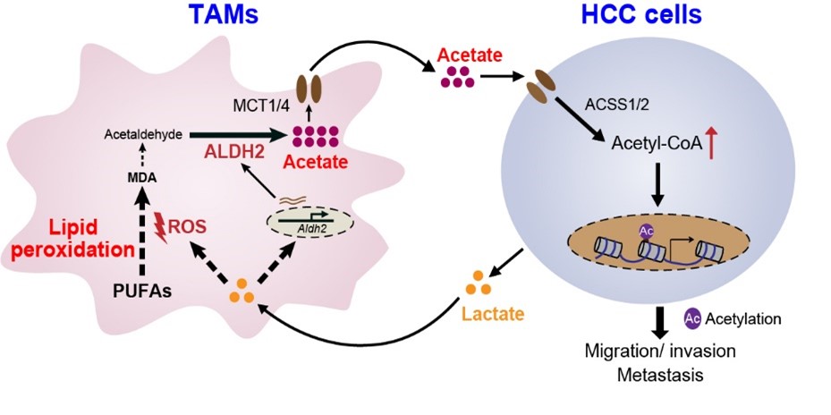 Tumor-associated Macrophages Serve as an Acetate Reservoir to Drive Hepatocellular Carcinoma Metastasis